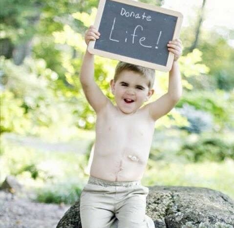 Jackson holds a Donate Life sign while proudly showing his transplant scars.